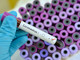 Coronavirus: i nuovi contagiati in provincia sono 36, in Liguria positivo un tampone ogni 19
